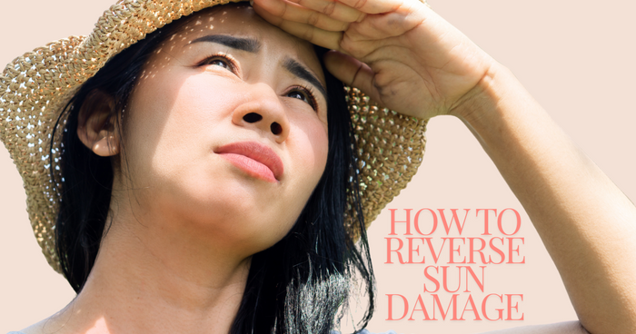 How to Reverse Sun Damage and Brighten Dark Spots